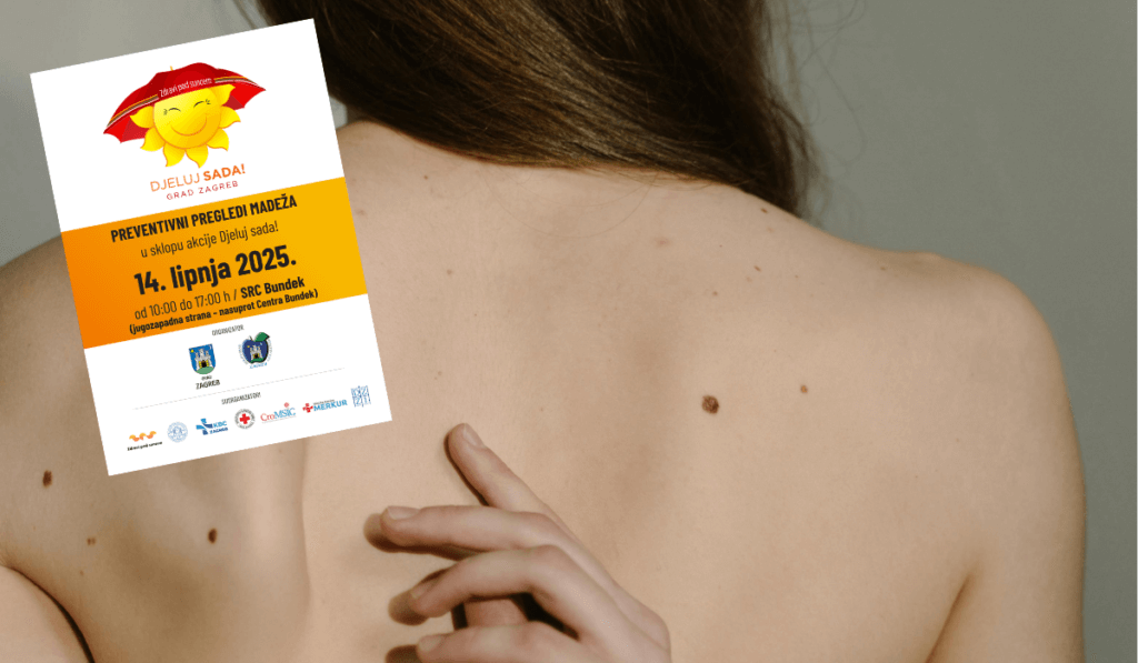 Preventivni pregled madeža